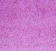 Larmes de Cassis